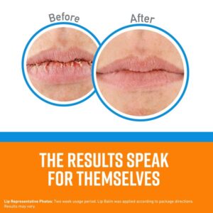 3 - Pack : O'Keeffe's K0710130-3 Cooling Lip Repair Stick (3 Pack) - Image 4