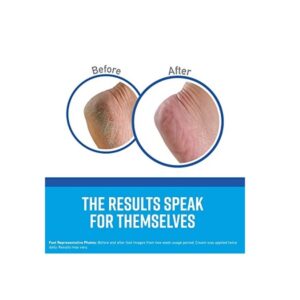 6 Pack O'Keefes 3200 O'Keeffe's for Healthy Feet Creme 3.2-oz Grip Pak - Image 3