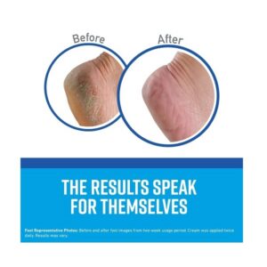 O'Keeffes 03200 2-Pack 3.2 oz Healthy Feet Dry Feet Daily Moisturizer Cream - Image 3