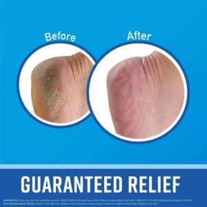 O'Keeffe's 3Oz Healthy Cream Feet Tube - Image 2