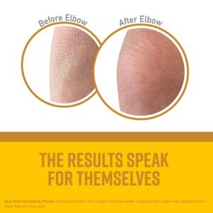 O'Keeffe's K0700008 Skin Repair Tube, 7 oz - Image 2